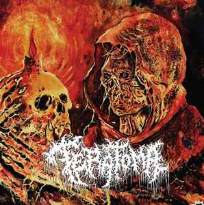 Teratoma  - Purulent Manifestations - CD